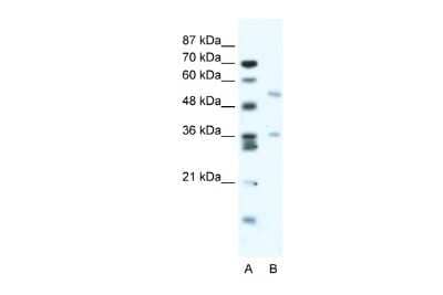 Western Blot: BTBD3 Antibody [NBP2-87093]