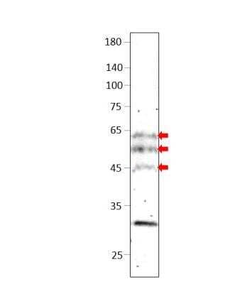 Western Blot: BTBD3 Antibody [NBP3-12291]