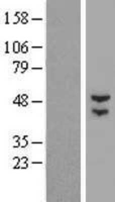 Western Blot: BTBD3 Overexpression Lysate [NBP2-04924]