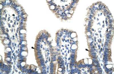 Immunohistochemistry: BTBD6 Antibody [NBP2-84524]