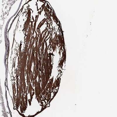 Immunohistochemistry-Paraffin: BTBD6 Antibody [NBP1-88672]