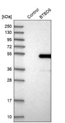 Western Blot: BTBD6 Antibody [NBP1-88672]