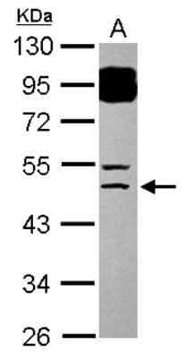 Western Blot: BTBD6 Antibody [NBP2-15627]