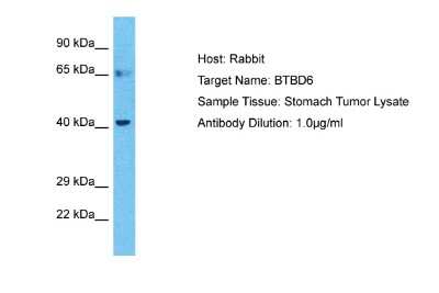 Western Blot: BTBD6 Antibody [NBP2-84523]