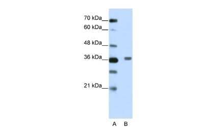 Western Blot: BTBD6 Antibody [NBP2-84524]