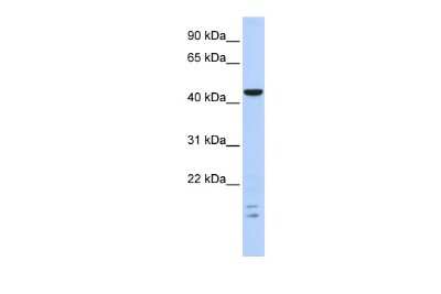 Western Blot: BTBD6 Antibody [NBP2-84525]