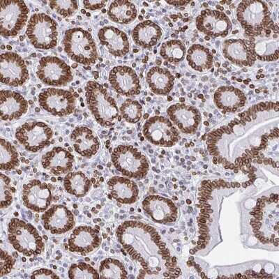 Immunohistochemistry: BTBD7 Antibody [NBP2-38699]