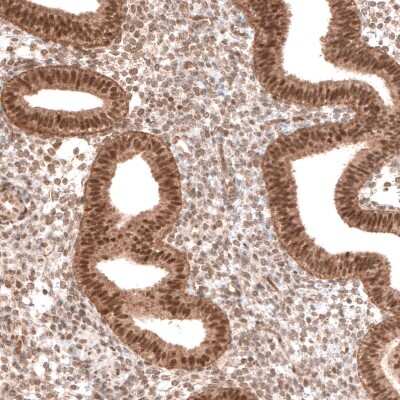 Immunohistochemistry-Paraffin: BTBD7 Antibody [NBP2-14364]