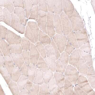 Immunohistochemistry-Paraffin: BTBD7 Antibody [NBP2-14364]