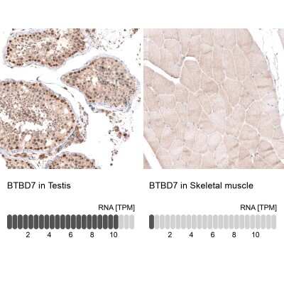 Immunohistochemistry-Paraffin: BTBD7 Antibody [NBP2-14364]