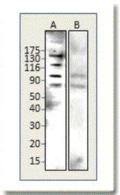 Western Blot: BTBD7 Antibody [NBP1-49652]