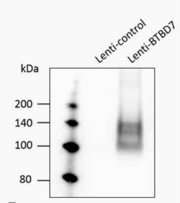 Western Blot: BTBD7 Antibody [NBP1-49652]