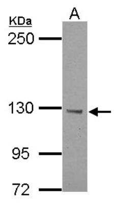 Western Blot: BTBD7 Antibody [NBP2-15628]