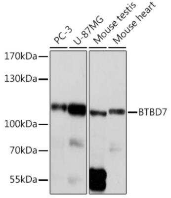 Western Blot: BTBD7 AntibodyAzide and BSA Free [NBP2-92399]