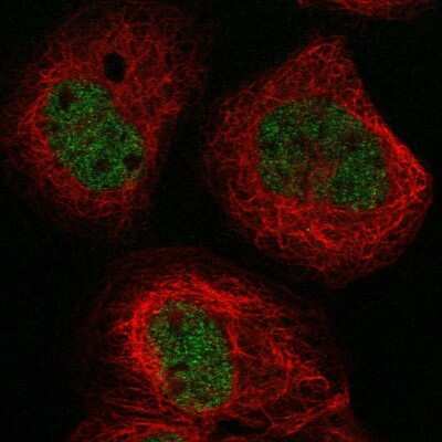 Immunocytochemistry/ Immunofluorescence: BTBD8 Antibody [NBP1-89429]