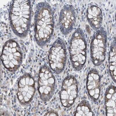 Immunohistochemistry: BTBD8 Antibody [NBP2-38246]