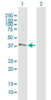 Western Blot: BTBD8 Antibody [H00284697-B01P]