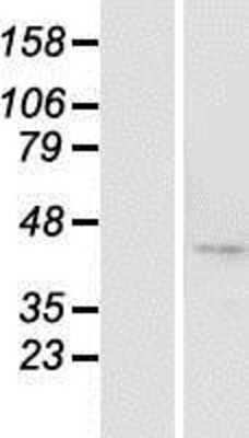 Western Blot: BTBD8 Overexpression Lysate [NBP2-04783]