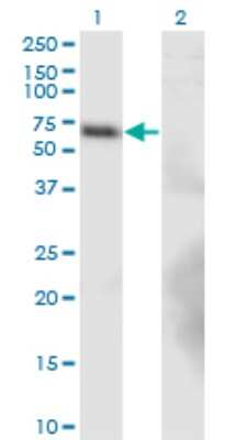 Western Blot: BTBD9 Antibody (1G3) [H00114781-M02]