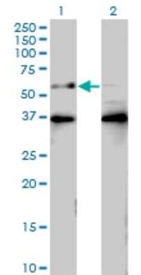 Western Blot: BTBD9 Antibody (3H3) [H00114781-M01]