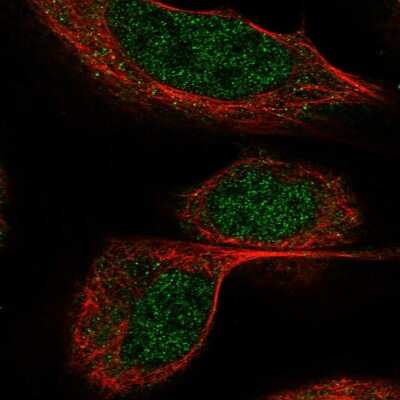 Immunocytochemistry/ Immunofluorescence: BTBD9 Antibody [NBP1-84228]