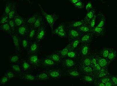 Immunocytochemistry/ Immunofluorescence: BTBD9 Antibody [NBP3-05962]