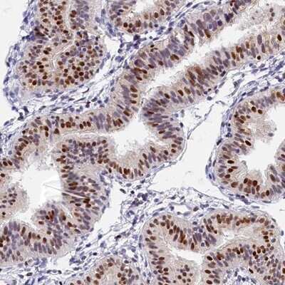 Immunohistochemistry-Paraffin: BTBD9 Antibody [NBP1-84228]