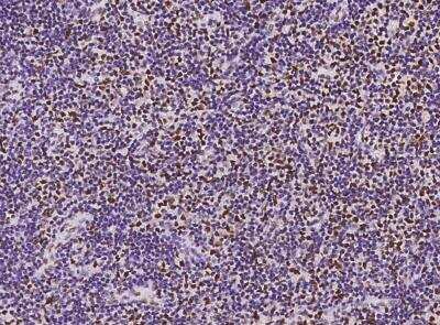 Immunohistochemistry-Paraffin: BTBD9 Antibody [NBP3-05962]