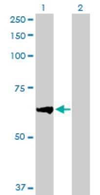 Western Blot: BTBD9 Antibody [H00114781-B01P]