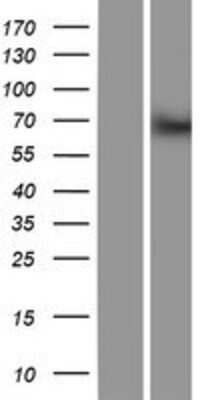 Western Blot: BTBD9 Overexpression Lysate [NBP2-05845]