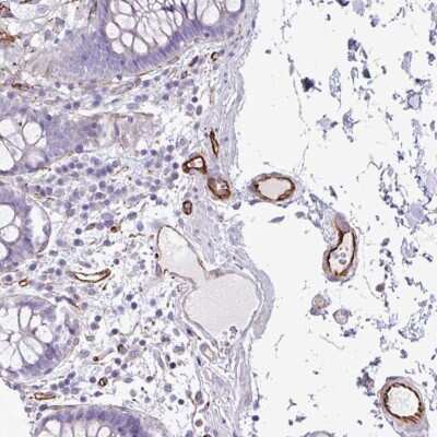 Immunohistochemistry-Paraffin: Biotinidase/BTD Antibody [NBP2-33644]