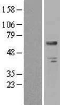 Western Blot: Biotinidase/BTD Overexpression Lysate [NBL1-08045]