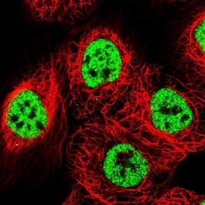 Immunocytochemistry/ Immunofluorescence: BTF Antibody [NBP1-89924]