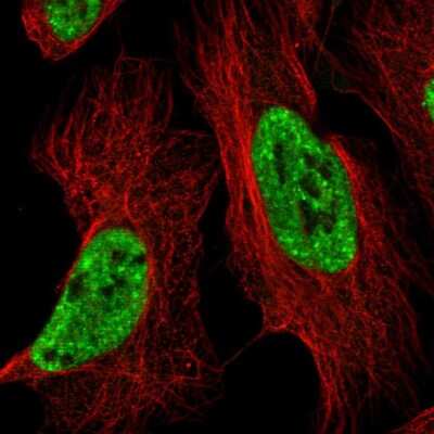 Immunocytochemistry/ Immunofluorescence: BTF Antibody [NBP2-58887]