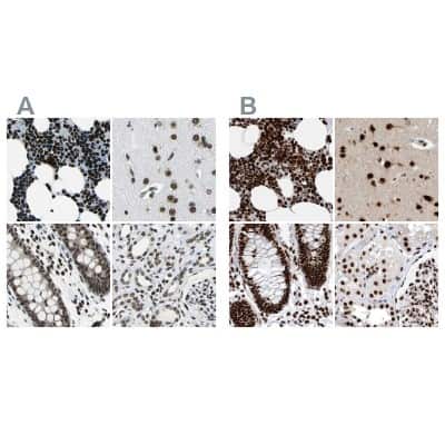 Immunohistochemistry-Paraffin: BTF Antibody [NBP1-89923]