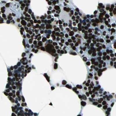 Immunohistochemistry-Paraffin: BTF Antibody [NBP1-89923]