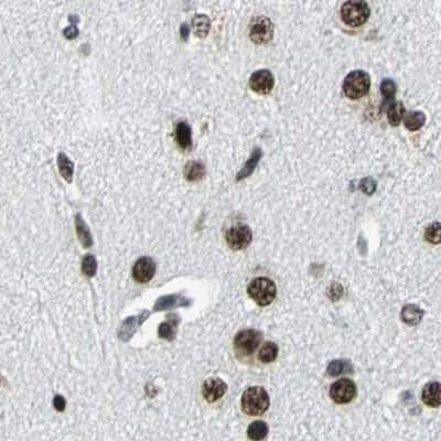 Immunohistochemistry-Paraffin: BTF Antibody [NBP1-89923]