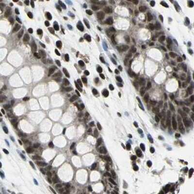 Immunohistochemistry-Paraffin: BTF Antibody [NBP1-89923]