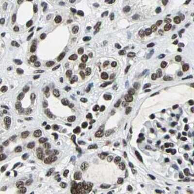 Immunohistochemistry-Paraffin: BTF Antibody [NBP1-89923]