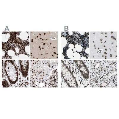Immunohistochemistry-Paraffin: BTF Antibody [NBP1-89924]