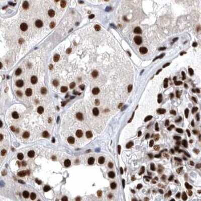 Immunohistochemistry-Paraffin: BTF Antibody [NBP1-89924]