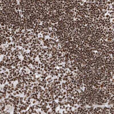 Immunohistochemistry-Paraffin: BTF Antibody [NBP1-89924]