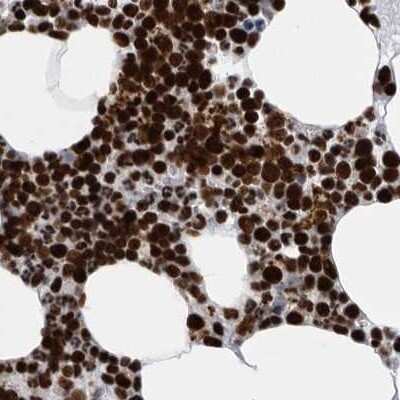 Immunohistochemistry-Paraffin: BTF Antibody [NBP1-89924]