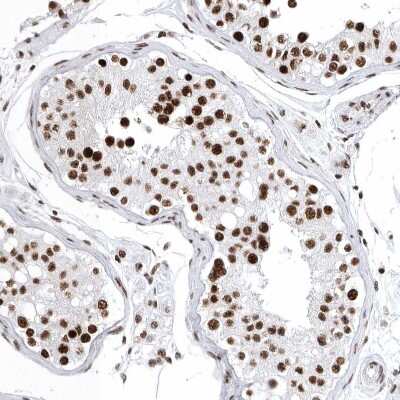Immunohistochemistry-Paraffin: BTF Antibody [NBP1-89924]