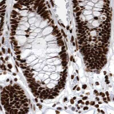 Immunohistochemistry-Paraffin: BTF Antibody [NBP1-89924]