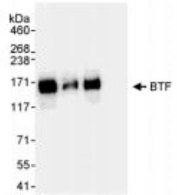 Immunoprecipitation: BTF Antibody [NB100-1704]