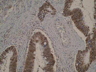 Immunohistochemistry: BTF Antibody (M33-P5B11) - BSA Free [NBP2-50118]