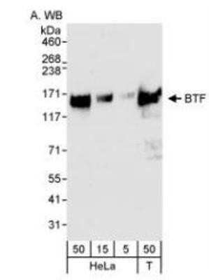 Western Blot: BTF Antibody [NB100-1704]