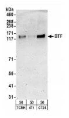 Western Blot: BTF Antibody [NB100-1704]