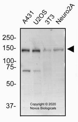 Western Blot: BTF Antibody [NBP2-24859]